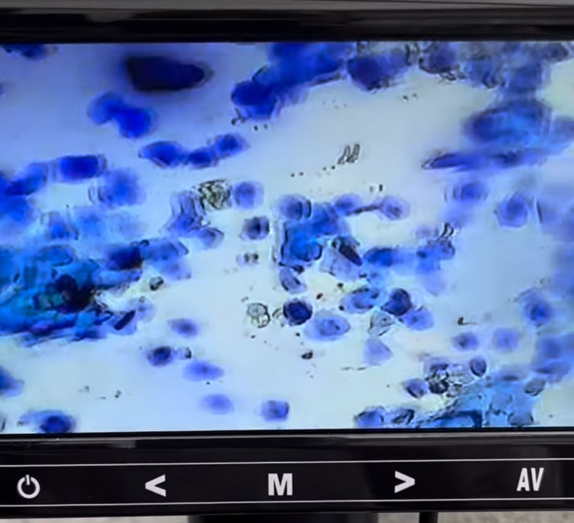 Cytology Testing